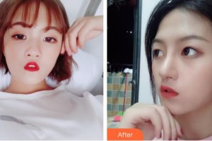 北海美秀中禾医疗美容诊所谢诗涓整形价格表附眼部综合案例展示
