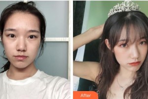 荆州美傲医疗美容诊所黄诚斌整形价格表附微创疤痕修复案例展示