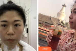 孝感欧阳整形美容诊所王珺整形价格表附热玛吉案例展示