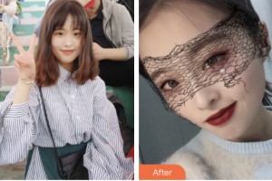株洲中雅医疗美容门诊部喻欣整形价格表附肋软骨隆鼻案例展示