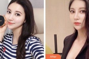 株洲嘉美医疗整形美容诊所张宾整形价格表附鼻部综合案例展示