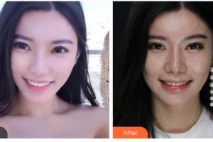 榆林妇产专科医院韩式整形美容中心刘轶整形价格表附美白贴片案例展示