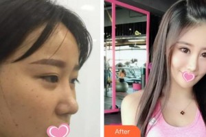 解放军总装备部后勤部医学整形中心马长生整形价格表附激光美肤激光案例展示