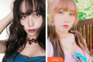 中国医科大学航空总医院皮肤激光整形美容中心顾军整形价格表附清洁祛痘案例展示