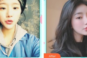 中国医药城医院微创整形美容中心朱宁文整形价格表附光子嫩肤案例展示