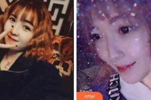 福清天宝美容医院蔡黎光整形价格表附超声波洁牙案例展示