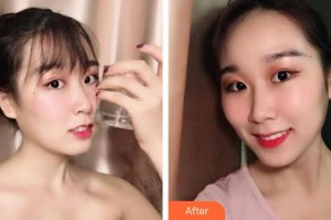 象山华美整形美容医院赵诚厚整形价格表附牙齿隐形矫正案例展示