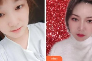 象山爱尔眼科医院贾知微整形价格表附埋线双眼皮案例展示