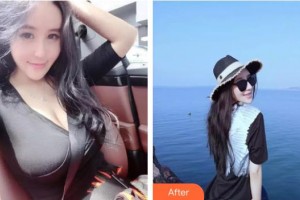 郴州现代女子医院医学整形中心颜岚亭整形价格表附膨体隆鼻案例展示