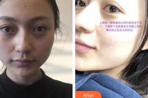 郴州瑞澜医疗美容医院赵小中主诊医师整形价格表附激光祛斑案例展示