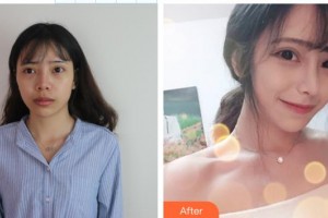 郴州市第四人民医院沈斌整形价格表附鼻修复例展示