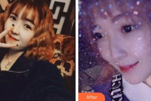 西昌口腔医院王秀华整形价格表附超声波洁牙案例展示