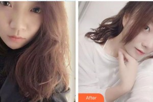 石狮宝岛栢丽医疗美容医院范善进主诊医师整形价格表附激光祛斑案例展示