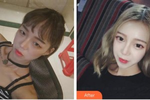 济源尖峰眼科医院胡成功整形价格表附眼部综合案例展示