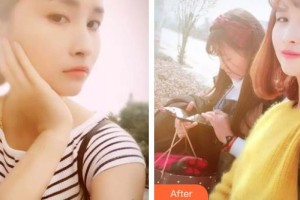 济源霍氏口腔医院石明军整形价格表附美白剂美白牙齿案例展示