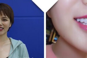 大理丽颜医学整形美容诊所陈方中整形价格表附牙贴面案例展示