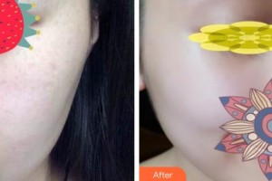 大理丽颜医学整形美容诊所杨成整形价格表附补水保湿案例展示