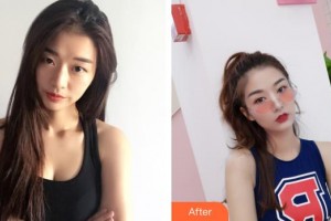 邯郸都市整形美容医院罗飓元整形价格表附内切祛眼袋案例展示