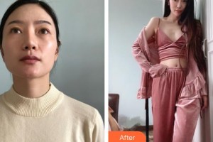 邯郸曲胜星范医疗美容门诊部颜红亮整形价格表附切开双眼皮案例展示