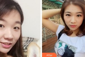 汉口爱尔眼科医院李璟整形价格表附眼部综合案例展示