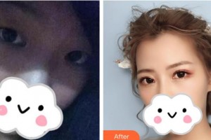 汉口爱尔眼科医院姜黎整形价格表附眼部综合案例展示