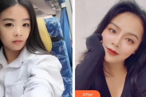 汉口爱尔眼科医院常晓可整形价格表附眼部综合案例展示