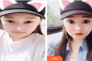 西南医科大学附属医院整形烧伤外科耿康整形价格表附埋线提升案例展示