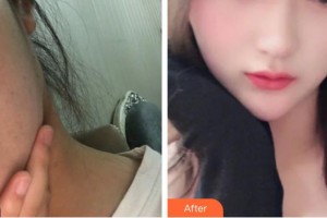 李国伟整形价格表附激光美肤激光案例展示