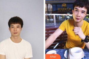 谭筱姗整形价格表附鼻部综合案例展示