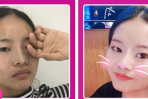 樊枝花凝美医疗美容诊所宋勇整形价格表附光子嫩肤案例展示