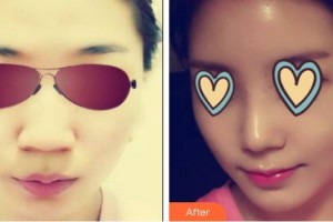 吴甲声教授整形价格表附鼻部综合案例展示