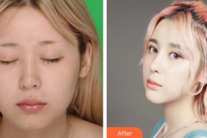 王敢整形价格表附鼻部综合案例展示