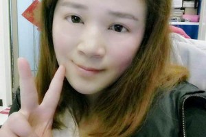 江苏艾美莉医院双眼皮正规吗?真人反馈\医生介绍