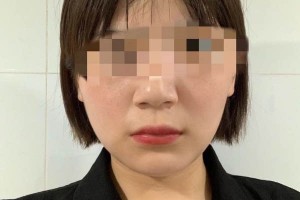 遵义韩美整形医院下颌角靠谱吗？医生名单介绍！