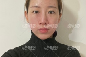 成都军大美容整形医院口口碑好吗？附医院介绍+祛斑果